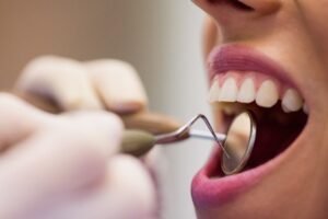 Top Reasons Residents Choose A Local Dentist In Selkirk For Oral Health